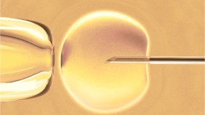 IVF