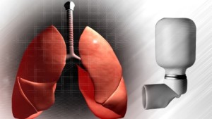 Asthma4