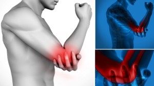 arthritis22