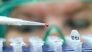 hiv positive test