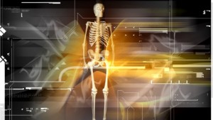 how to aviod osteoporosis