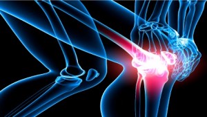 knee arthrits